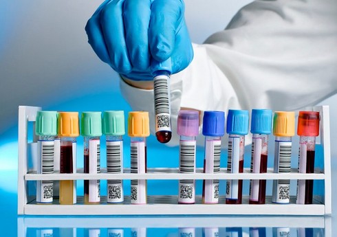 Azərbaycan boksçusu dopinqə görə cəzalandırılıb