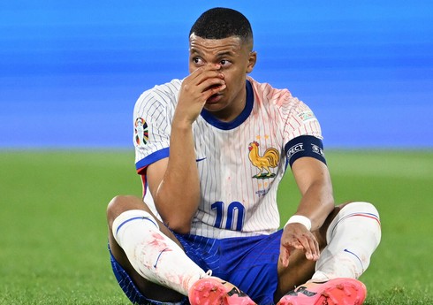 KİV: Mbappenin burun sümüyü sınıb, əməliyyat olunacaq